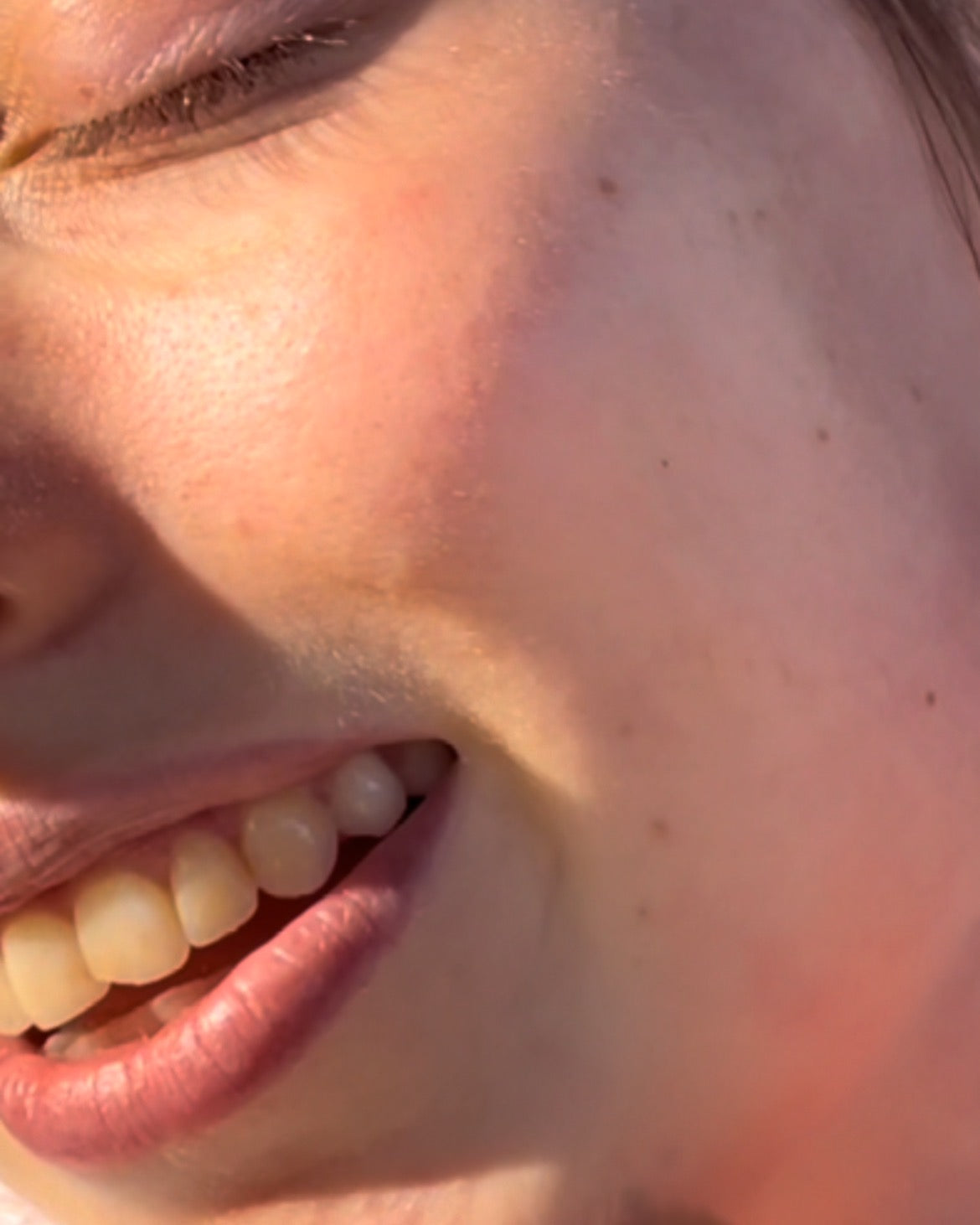 normal skin type