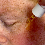 Applying Sealuxe Protect facial oil to freckled skin