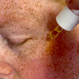 Applying Sealuxe Protect facial oil to freckled skin