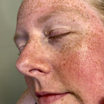 Close-up of glowing skin with freckles after applying Sealuxe facial oil